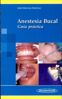 ANESTESIA BUCAL GUIA PRACTICA