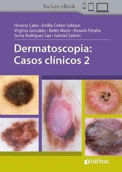 DERMATOSCOPIA CASOS CLINICOS 2