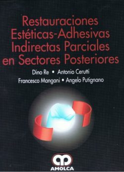 RESTAURACIONES ESTETICAS ADHESIVAS INDIRECTAS PARCIALES