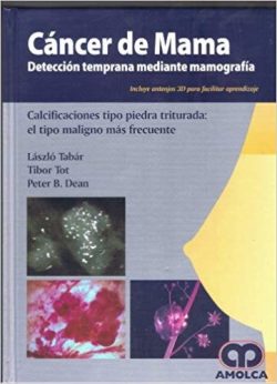 CANCER DE MAMA DETECCION TEMPRANA MEDIANTE MAMOGRAFIA