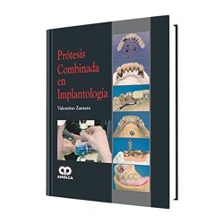 PROTESIS COMBINADA EN IMPLANTOLOGIA