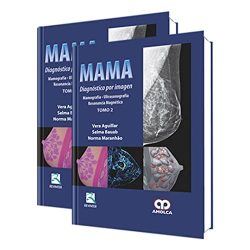 MAMA DIAGNOSTICO POR IMAGEN