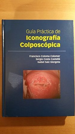 GUIA PRACTICA DE ICONOGRAFIA COLPOSCOPICA