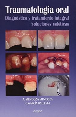 TRAUMATOLOGIA ORAL DIAGNOSTICO Y TRATAMIENTO