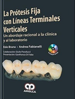 LA PROTESIS FIJA CON LINEAS TERMINALES VERTICALES