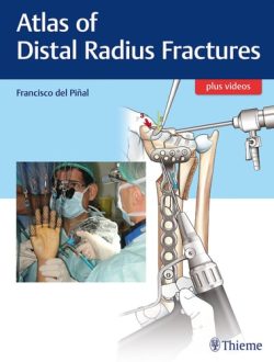 ATLAS DE FRACTURAS DISTALES DE RADIO