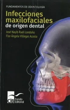 INFECCIONES MAXILOFACIALES DE ORIGEN DENTAL