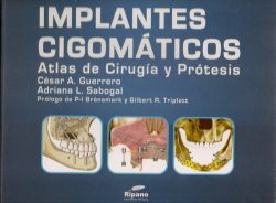 IMPLANTES CIGOMATICOS ATLAS DE CIRUGIA Y PROTESIS