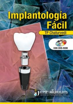 IMPLANTOLOGIA FACIL