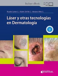 LASER Y OTRAS TECNOLOGIAS EN DERMATOLOGIA