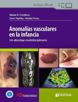 ANOMALIAS VASCULARES EN LA INFANCIA